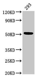 Western Blot  | Positive WB detected in: 293 whole cell lysate  | All lanes: TUBB3 antibody at 3µg/ml  | Secondary  | Goat polyclonal to rabbit IgG at 1/50000 dilution  | Predicted band size: 51, 43 kDa  | Observed band size: 51 kDaRabbit anti-Human TUBB3 Polyclonal Antibody