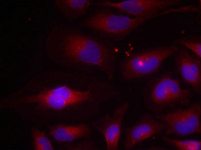 Immunofluorescence staining of methanol-fixed HeLa cells using NF-kappa;B p100(phospho-Ser870) antibody.Rabbit anti-Human NFKB2 Polyclonal Antibody