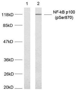 Western blot analysis of extract from MDA-MB-435 cells untreated or treated with TNF-alpha; (20ng/ml, 5min) using NF-κB p100(phospho-Ser870) antibody.Rabbit anti-Human NFKB2 Polyclonal Antibody