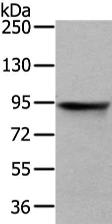 Gel: 6%SDS-PAGE, Lysate: 40 μg, Lane: HT-29 cell, Primary antibody: VIL1 Antibody(VIL1 Antibody) at dilution 1/250 dilution, Secondary antibody: Goat anti rabbit IgG at 1/8000 dilution, Exposure time: 3 secondsRabbit anti-Human VIL1 Polyclonal Antibody