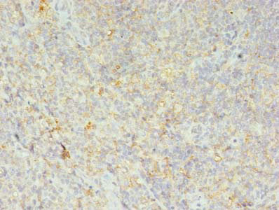 Immunohistochemistry of paraffin-embedded human tonsil tissue using HLA-DRB4 Antibody at dilution of 1:100Rabbit anti-Human HLA-DRB4 Polyclonal Antibody