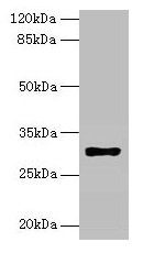 Western blot  | All lanes: HLA-DRB4 antibody at 2µg/ml + Raji whole cell lysate  | Secondary  | Goat polyclonal to rabbit IgG at 1/10000 dilution  | Predicted band size: 30 kDa  | Observed band size: 30 kDaRabbit anti-Human HLA-DRB4 Polyclonal Antibody