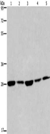 Gel: 8%SDS-PAGE, Lysate: 40 μg, Lane 1-5: A375 cells, K562 cells, Hela cells, HepG2 cells, 293T cells, Primary antibody: EIF6 Antibody(EIF6 Antibody) at dilution 1/200, Secondary antibody: Goat anti rabbit IgG at 1/8000 dilution, Exposure time: 20 secondsRabbit anti-Human EIF6 Polyclonal Antibody