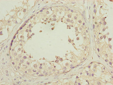 Immunohistochemistry of paraffin-embedded human testis tissue using DNAJB1 Antibody at dilution of 1:100Rabbit anti-Human DNAJB1 Polyclonal Antibody