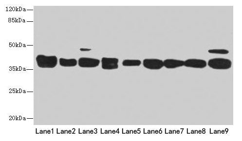 Western blot  | All lanes: DNAJB1 antibody at 3µg/ml  | Lane 1: Mouse spleen tissue  | Lane 2: Colo320 whole cell lysate  | Lane 3: Hela whole cell lysate  | Lane 4: LO2 whole cell lysate  | Lane 5: HepG2 whole cell lysate  | Lane 6: HT29 whole cell lysate  | Lane 7: A549 whole cell lysate  | Lane 8: Jurkat whole cell lysate  | Lane 9: MCF-7 whole cell lysate  | Secondary  | Goat polyclonal to rabbit IgG at 1/10000 dilution  | Predicted band size: 39, 28 kDa  | Observed band size: 39 kDaRabbit anti-Human DNAJB1 Polyclonal Antibody