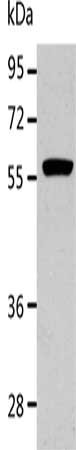 Gel: 10%SDS-PAGE, Lysate: 40 μg, Lane: K562 cells, Primary antibody: ALDH1A2 Antibody(ALDH1A2 Antibody) at dilution 1/400, Secondary antibody: Goat anti rabbit IgG at 1/8000 dilution, Exposure time: 5 secondsRabbit anti-Human ALDH1A2 Polyclonal Antibody