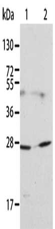 Gel: 12%SDS-PAGE, Lysate: 40 μg, Lane 1-2: 231 cells, HT29 cells, Primary antibody: KLK15 Antibody(KLK15 Antibody) at dilution 1/200, Secondary antibody: Goat anti rabbit IgG at 1/8000 dilution, Exposure time: 1 minute