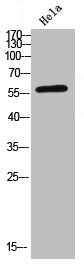 Western Blot analysis of hela using NFκB-p65 Polyclonal Antibody.Rabbit anti-Human RELA Polyclonal Antibody