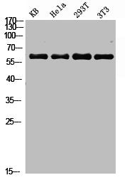 Western blot analysis of KB Hela 293T 3T3 lysis using NFκB-p65 antibody.Rabbit anti-Human RELA Polyclonal Antibody