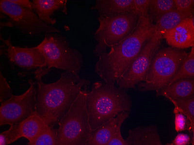 Immunofluorescence staining of methanol-fixed MCF cells using Estrogen Receptor-a(Phospho-Ser167) Antibody.Rabbit anti-Human ESR1 Polyclonal Antibody