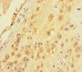 Immunohistochemistry of paraffin-embedded human placenta tissue using SARS Antibody at dilution of 1:100Rabbit anti-Human SARS Polyclonal Antibody