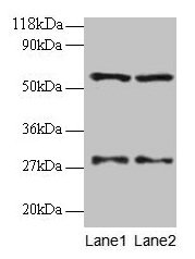 Western blot  | All lanes: SARS antibody at 2µg/ml  | Lane 1: EC109 whole cell lysate  | Lane 2: 293T whole cell lysate  | Secondary  | Goat polyclonal to rabbit IgG at 1/15000 dilution  | Predicted band size: 59 kDa  | Observed band size: 59 kDaRabbit anti-Human SARS Polyclonal Antibody