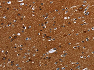 The image on the left is immunohistochemistry of paraffin-embedded Human brain  tissue using SLC22A12 Antibody(SLC22A12 Antibody) at dilution 1/20, on the right is treated with synthetic peptide. (Original magnification: ×200)Rabbit anti-Human SLC22A12 Polyclonal Antibody