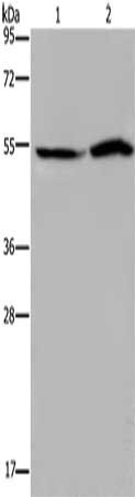 Gel: 8%SDS-PAGE, Lysate: 40 μg, Lane 1-2: Hela cells, 293T cells, Primary antibody: SLC22A12 Antibody(SLC22A12 Antibody) at dilution 1/200, Secondary antibody: Goat anti rabbit IgG at 1/8000 dilution, Exposure time: 40 secondsRabbit anti-Human SLC22A12 Polyclonal Antibody