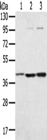 Gel: 8%SDS-PAGE, Lysate: 40 μg, Lane 1-3: Hepg2 cells, TM4 cells, Raw264.7 cells, Primary antibody: STX18 Antibody(STX18 Antibody) at dilution 1/300, Secondary antibody: Goat anti rabbit IgG at 1/8000 dilution, Exposure time: 20 secondsRabbit anti-Human STX18 Polyclonal Antibody