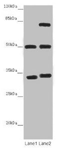 Western blot  | All lanes: TUBA1B antibody at 12 μg/ml  | Lane 1: Mouse brain tissue  | Lane 2: Mouse liver tissue  | Secondary  | Goat polyclonal to rabbit IgG at 1/10000 dilution  | Predicted band size: 51, 38 kDa  | Observed band size: 51, 34, 75 kDaRabbit anti-Human TUBA1B Polyclonal Antibody