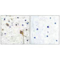 Immunohistochemical analysis of paraffin-embedded human brain tissue using SH-PTP2 antibody.Rabbit anti-Human PTPN11 Polyclonal Antibody