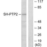 Western blot analysis of extracts from COS7 cells, using SH-PTP2 antibody.Rabbit anti-Human PTPN11 Polyclonal Antibody