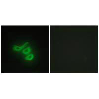 Immunofluorescence analysis of HepG2 cells, using M-CK antibody.Rabbit anti-Human CKM Polyclonal Antibody