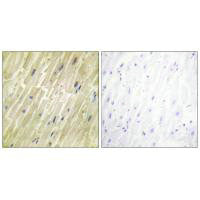 Immunohistochemistry analysis of paraffin-embedded human heart tissue using M-CK antibody.Rabbit anti-Human CKM Polyclonal Antibody