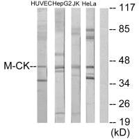 Western blot analysis of extracts from HUVEC cells, HepG2 cells, Jurkat cells and HeLa cells, using M-CK antibody.Rabbit anti-Human CKM Polyclonal Antibody