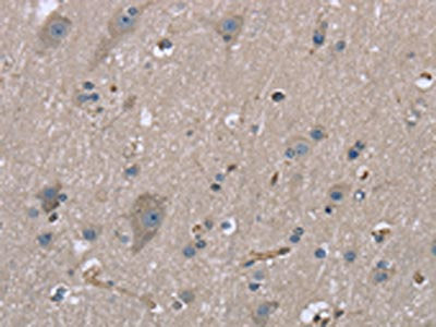 The image on the left is immunohistochemistry of paraffin-embedded Human brain tissue using the antibody Antibody) at dilution 1/20, on the right is treated with fusion protein. (Original magnification: ×200)Rabbit anti-Human MYL12B Polyclonal Antibody