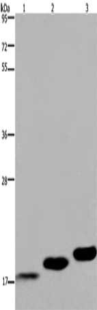Gel: 8%SDS-PAGE, Lysate: 40 μg, Lane 1-3: Mouse skeletal muscle, Mouse heart tissue, Mouse bladder tissue, Primary antibody: MYL12B Antibody(MYL12B Antibody) at dilution 1/450, Secondary antibody: Goat anti rabbit IgG at 1/8000 dilution, Exposure time: 20 secondsRabbit anti-Human MYL12B Polyclonal Antibody