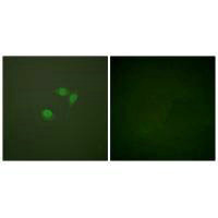 Immunofluorescence analysis of NIH/3T3 cells, using Sumo1 antibody.Rabbit anti-Human SUMO1 Polyclonal Antibody
