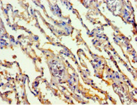 Immunohistochemistry of paraffin-embedded human lung tissue using TALDO1 Antibody at dilution of 1:100Rabbit anti-Human TALDO1 Polyclonal Antibody