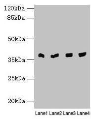 Western blot  | All lanes: TALDO1 antibody at 0.1µg/ml  | Lane 1: Human placenta tissue  | Lane 2: Hela whole cell lysate  | Lane 3: Jurkat whole cell lysate  | Lane 4: A375 whole cell lysate  | Secondary  | Goat polyclonal to rabbit IgG at 1/10000 dilution  | Predicted band size: 38 kDa  | Observed band size: 38 kDaRabbit anti-Human TALDO1 Polyclonal Antibody