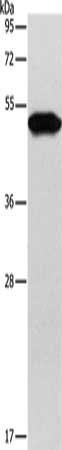 Gel: 10%SDS-PAGE, Lysate: 40 μg, Lane: Hela cells, Primary antibody: KRT81 Antibody(KRT81 Antibody) at dilution 1/200, Secondary antibody: Goat anti rabbit IgG at 1/8000 dilution, Exposure time: 30 seconds