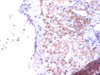 Immunohistochemistry of paraffin-embedded human liver tissue using PTDSS1 Antibody at dilution of 1:100Rabbit anti-Human PTDSS1 Polyclonal Antibody