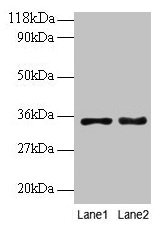 Western blot  | All lanes: PTDSS1 antibody at 2µg/ml  | Lane 1: EC109 whole cell lysate  | Lane 2: 293T whole cell lysate  | Secondary  | Goat polyclonal to rabbit IgG at 1/15000 dilution  | Predicted band size: 56, 39, 35 kDa  | Observed band size: 35 kDaRabbit anti-Human PTDSS1 Polyclonal Antibody