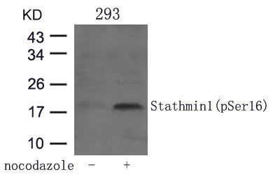 Western blot analysis of extracts from 293 cells untreated or treated with Nocodazol using Stathmin 1(Phospho-Ser16) Antibody.Rabbit anti-Human STMN1 Polyclonal Antibody