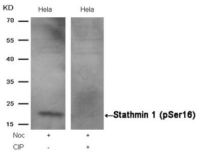 Western blot analysis of extracts from Hela cells, treated with Noc or calf intestinal phosphatase (CIP), using Stathmin 1 (Phospho-Ser16) Antibody.Rabbit anti-Human STMN1 Polyclonal Antibody