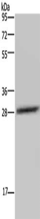 Gel: 10%SDS-PAGE, Lysate: 40 μg, Lane: LO2 cells, Primary antibody: CEBPD Antibody(CEBPD Antibody) at dilution 1/300, Secondary antibody: Goat anti rabbit IgG at 1/8000 dilution, Exposure time: 5 minutesRabbit anti-Human CEBPD Polyclonal Antibody