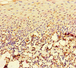 Immunohistochemistry of paraffin-embedded human tonsil tissue using the antibody at dilution of 1:100Rabbit anti-Human RAC1 Polyclonal Antibody