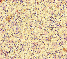 Immunohistochemistry of paraffin-embedded human spleen tissue using RAC1 Antibody at dilution of 1:100Rabbit anti-Human RAC1 Polyclonal Antibody