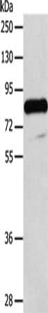 Gel: 8%SDS-PAGE, Lysate: 40 μg, Lane: Human testis tissue, Primary antibody: ADAM32 Antibody(ADAM32 Antibody) at dilution 1/100, Secondary antibody: Goat anti rabbit IgG at 1/8000 dilution, Exposure time: 10 minutes