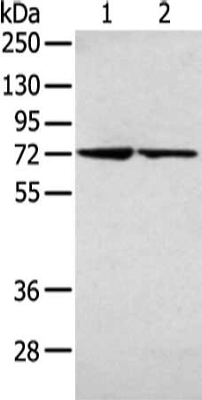 Gel: 8%SDS-PAGE, Lysate: 40 μg, Lane 1-2: 231 and 293T cell, Primary antibody: AGPS Antibody(AGPS Antibody) at dilution 1/200 dilution, Secondary antibody: Goat anti rabbit IgG at 1/8000 dilution, Exposure time: 5 secondsRabbit anti-Human AGPS Polyclonal Antibody