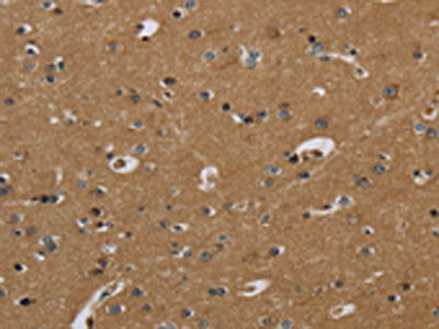 The image on the left is immunohistochemistry of paraffin-embedded Human brain  tissue using PAEP Antibody(PAEP Antibody) at dilution 1/60, on the right is treated with fusion protein. (Original magnification: ×200)Rabbit anti-Human PAEP Polyclonal Antibody