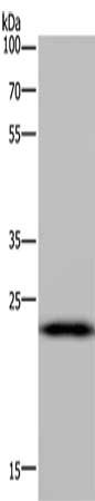 Gel: 10%SDS-PAGE, Lysate: 40 μg, Lane: Mouse liver tissue, Primary antibody: PAEP Antibody(PAEP Antibody) at dilution 1/300, Secondary antibody: Goat anti rabbit IgG at 1/8000 dilution, Exposure time: 5 minutesRabbit anti-Human PAEP Polyclonal Antibody