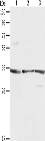 Gel: 10%SDS-PAGE, Lysate: 40 μg, Lane 1-3: NIH/3T3 cells, A431 cells, Jurkat cells, Primary antibody: RPLP0 Antibody(RPLP0 Antibody) at dilution 1/750, Secondary antibody: Goat anti rabbit IgG at 1/8000 dilution, Exposure time: 1 minuteRabbit anti-Human RPLP0 Polyclonal Antibody
