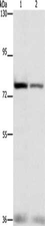 Gel: 6%SDS-PAGE, Lysate: 40 μg, Lane 1-2: HepG2 cells, hela cells, Primary antibody: NFE2L1 Antibody(NFE2L1 Antibody) at dilution 1/280, Secondary antibody: Goat anti rabbit IgG at 1/8000 dilution, Exposure time: 30 secondsRabbit anti-Human NFE2L1 Polyclonal Antibody