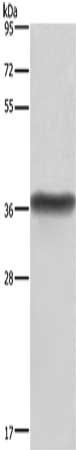 Gel: 8%SDS-PAGE, Lysate: 40 μg, Lane: Human placenta tissue, Primary antibody: HSD17B1 Antibody(HSD17B1 Antibody) at dilution 1/600, Secondary antibody: Goat anti rabbit IgG at 1/8000 dilution, Exposure time: 1 second