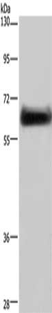 Gel: 8%SDS-PAGE, Lysate: 40 μg, Lane: Mouse brain tissue, Primary antibody: DPYSL3 Antibody(DPYSL3 Antibody) at dilution 1/200, Secondary antibody: Goat anti rabbit IgG at 1/8000 dilution, Exposure time: 30 secondsRabbit anti-Human DPYSL3 Polyclonal Antibody
