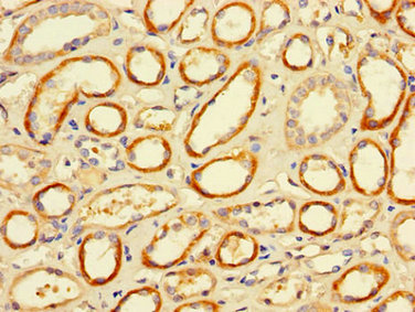 Immunohistochemistry of paraffin-embedded human kidney tissue using FCGR2A Antibody at dilution of 1:100Rabbit anti-Human FCGR2A Polyclonal Antibody