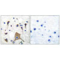 Immunohistochemical analysis of paraffin-embedded human brain tissue using GluR5 antibody.Rabbit anti-Human GRIK1 Polyclonal Antibody