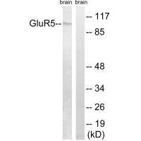 Western blot analysis of extracts from mouse brain, using GluR5 antibody.Rabbit anti-Human GRIK1 Polyclonal Antibody