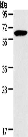 Gel: 8%SDS-PAGE, Lysate: 40 μg, Lane: Mouse brain tissue, Primary antibody: HMGCS2 Antibody(HMGCS2 Antibody) at dilution 1/200, Secondary antibody: Goat anti rabbit IgG at 1/8000 dilution, Exposure time: 2 minutesRabbit anti-Human HMGCS2 Polyclonal Antibody